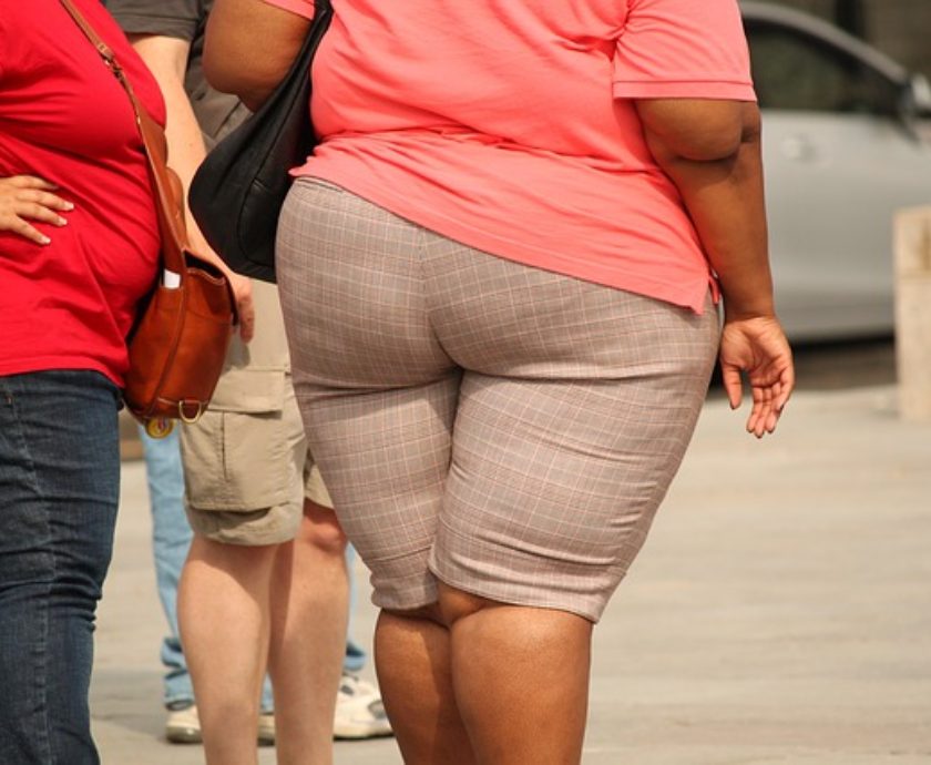 Obese People Fall into Six Categories