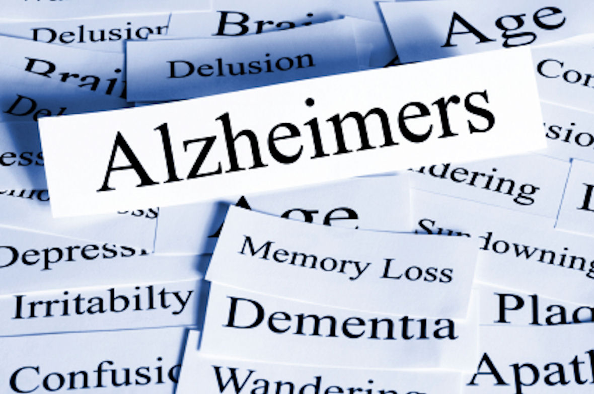 Obesity Linked to Earlier Onset of Alzheimer’s Disease